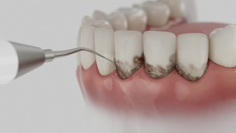 Reliable Dental Implants contractor in Richland, GA by Smile Center Dentistry
